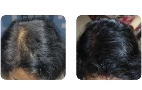 Fake Jojoba Oil Reviews & Best Betting Sites for 2026